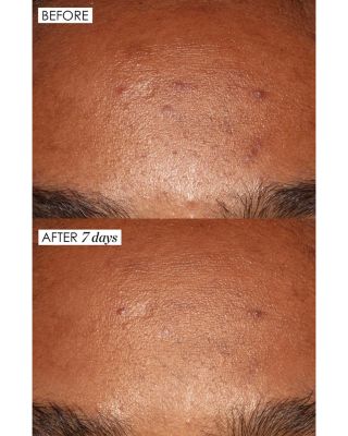 Jewel Box Gift Set ($64 value)