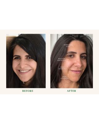 Superkind Daily Essentials Kit ($157 value)