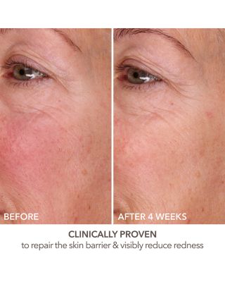 DermInfusions Fill + Repair Serum 1 oz.