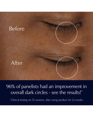 Advanced Night Repair Eye Cream Skincare Gift Set ($118 value)