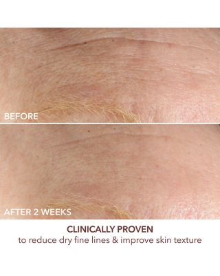 Advanced Retinol + Ferulic Intense Wrinkle Cream 2 oz.