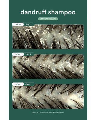 Dandruff Shampoo 8 oz.
