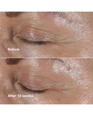 Smart Clinical Repair Wrinkle Correcting Eye Cream 0.5 oz.