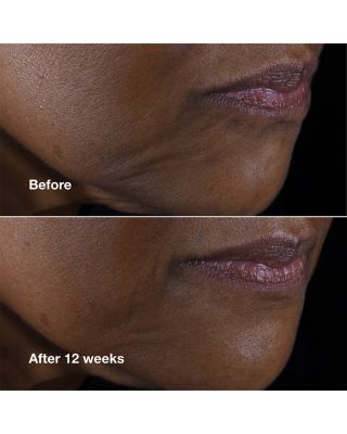 Smart Clinical Repair™ Lifting Face + Neck Cream 1.7 oz.