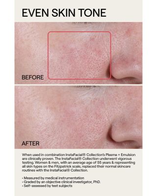 InstaFacial&reg; Plasma Bioactive Growth Factor Serum 1 oz.