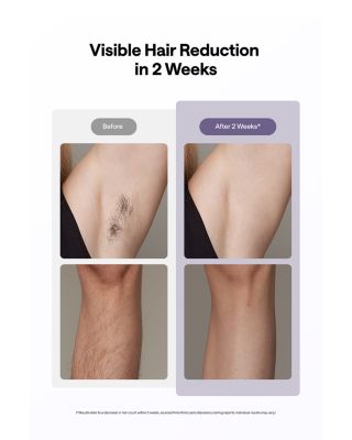  Ice Cooling IPL Hair Removal Device