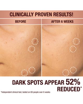 Dark Spot Correcting Radiance Recovery Serum 0.34 oz.
