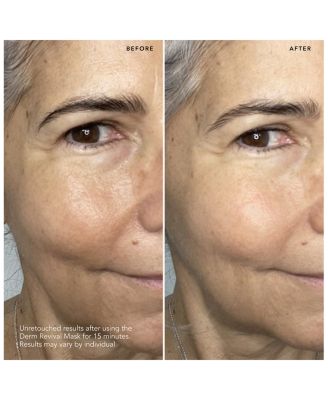 Brightening Source Derm Revival Mask, 10 Sheets