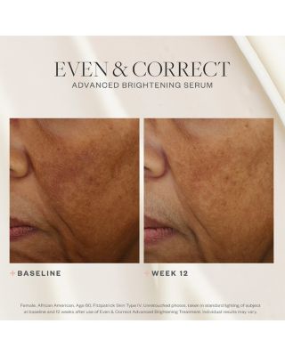 Even & Correct Advanced Brightening Treatment 2 oz.