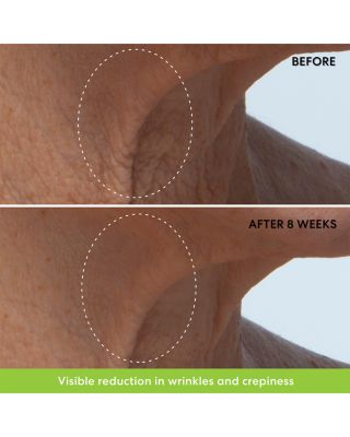 Phyto Retinol Neck Cream 1.7 oz.