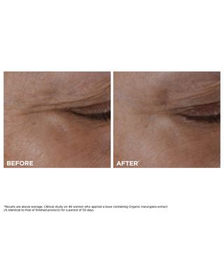 Total Eye Lift Eye Cream 0.5 oz.