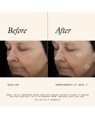 TNS Advanced+ Serum 1 oz.