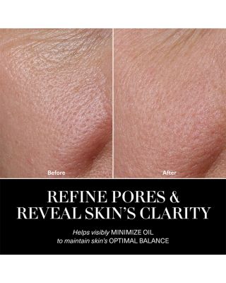 The Balancing Treatment Lotion 5.1 oz.