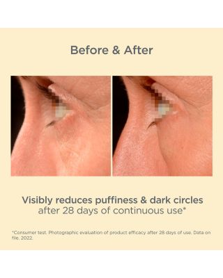 ISDINCEUTICS K-Ox Eyes 0.5 oz.