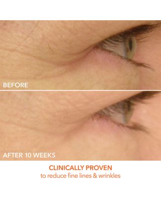 DRx SpectraLite EyeCare Max Pro