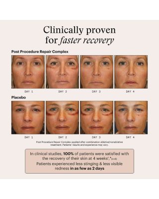 Post Procedure Repair Complex 1 oz.