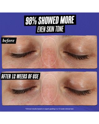 Clearly Corrective™ Dark Spot Solution 1.7 oz.