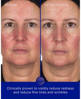 The Hydrogel Face Mask Single