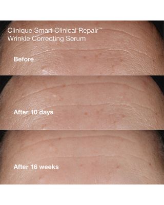 Smart Clinical Repair Mini Skincare Gift Set ($71 value)