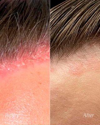 Clarifying Scalp Scrub 3.2 oz.