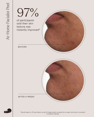 At Home Facialist Peel 1 oz.