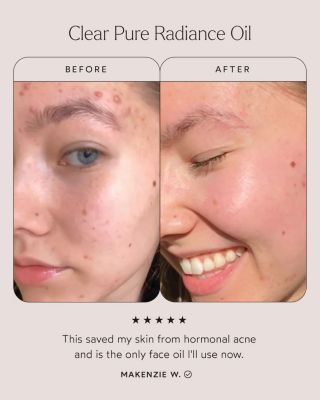 Clear Pure Radiance Oil 1 oz.