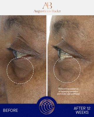 The Eye Cream Nomad 0.5 oz. (Refill)