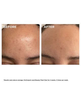 Beauty Flash Peel with BHA & AHA 1.7 oz.