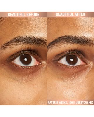 Refillable Magic Eye Rescue Cream with Retinol 0.5 oz.