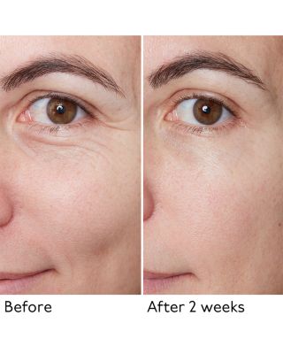 Hyaluronic Global Serum 1 oz.