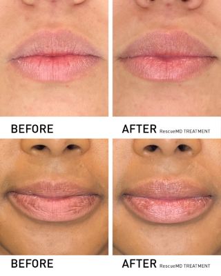 Restorative Lip Treatment 0.4 oz.