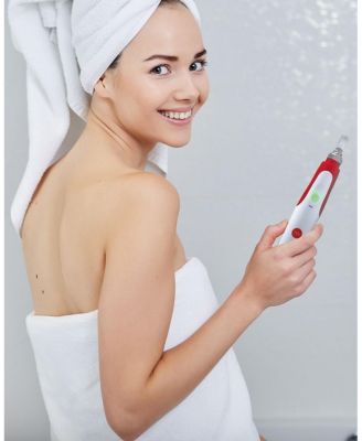 Electric Microneedle Roller Derma Pen System (0.25-2.0 mm Range) - Corded Version