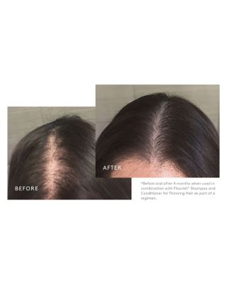 Flourish Minoxidil Foam