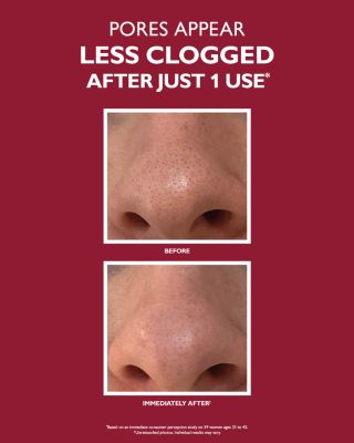 Even Smoother Microdermabrasion Exfoliating Pore Purifier 1.7 oz.