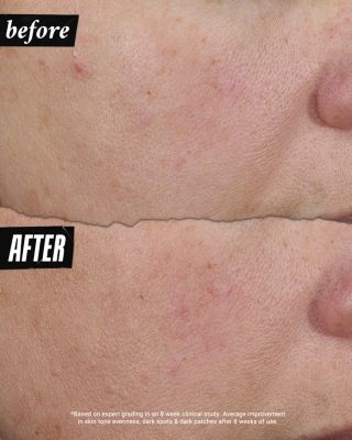 Auto Tone Discoloration & UV Solution 1.4 oz.