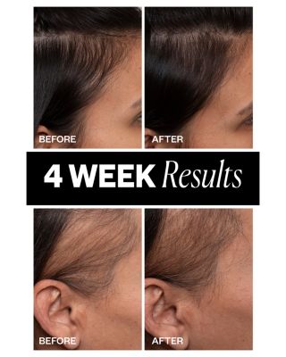 Sponsored High Density Scalp Treatment 2.1 oz.