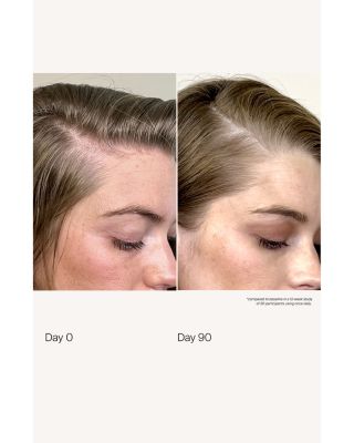 Scalp Care Density Serum 1.7 oz.