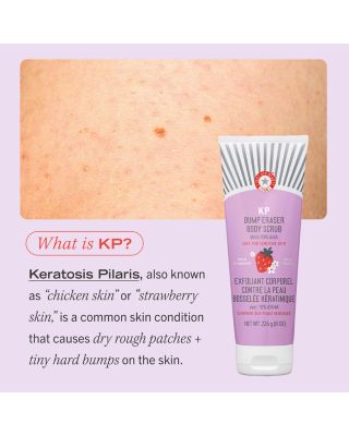 KP Bump Eraser Body Scrub with 10% AHA Body Exfoliant for Keratosis Pilaris - Strawberry 2 oz.