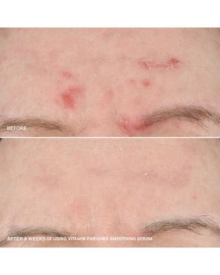 Boost Your Base Vitamin Enriched Moisturizer & Serum Set ($154 value)