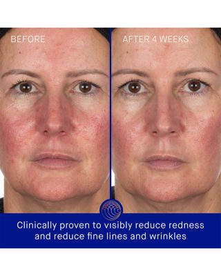 The Rich Renewal Trio Skincare Gift Set ($459 value)