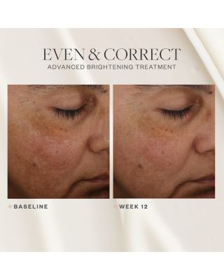 Even & Correct Advanced Brightening Treatment 2 oz.