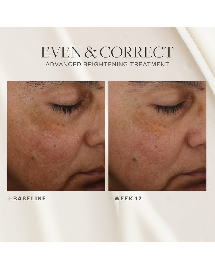 Even & Correct Advanced Brightening Treatment 2 oz.