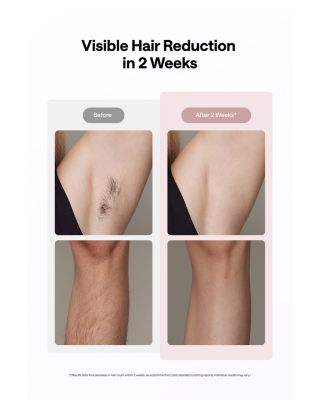  Ice Cooling IPL Hair Removal Device