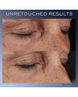 Advanced G&eacute;nifique Yeux Eye Cream