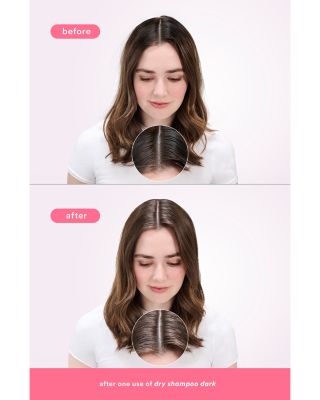 Dry Shampoo Dark 5 oz.