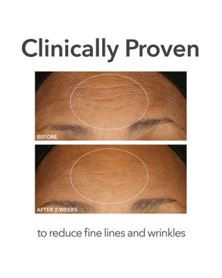 Alpha Beta Extra Strength Daily Peel, 30 Pads