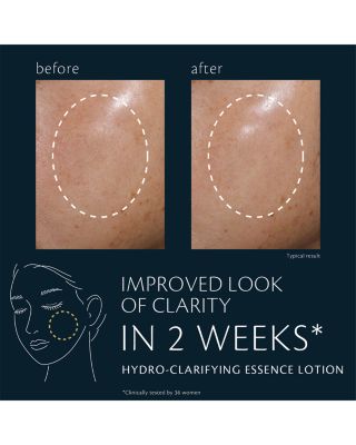 Hydro Clarifying Essence Lotion 5.7 oz.
