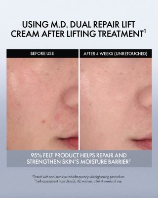 Dual Repair Lift Cream 1 oz.