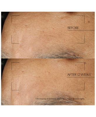 Advanced Night Repair Overnight Treatment 2 oz.