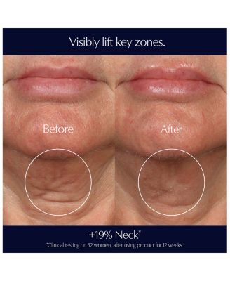 Perfectionist Pro Rapid Firm + Lift Serum 1 oz.